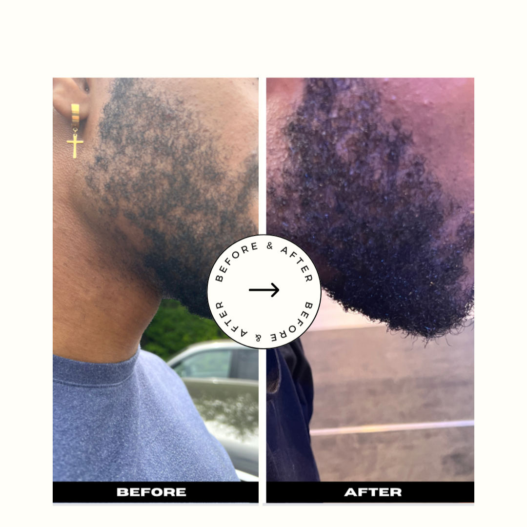 Cure pousse, 90 Jours pour Une Repousse Intense