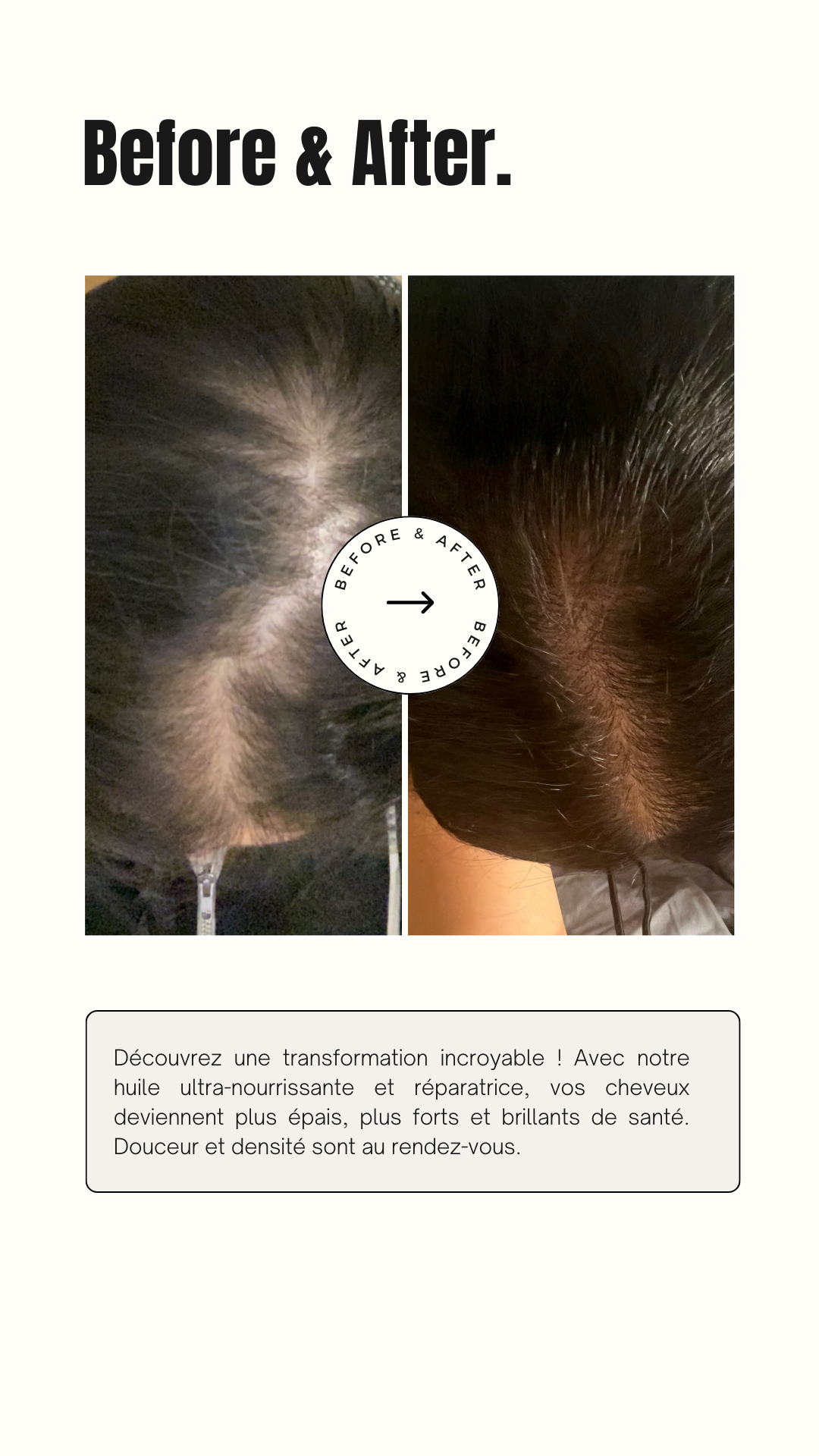 Cure pousse, 90 Jours pour Une Repousse Intense